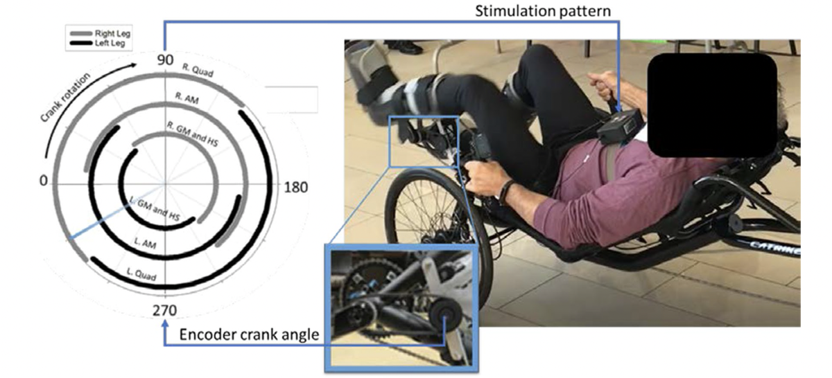Neural Stimulation Devices for Induced Exercise in SCI Individuals TechLink